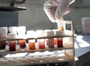 Лечение стволовыми клетками официально зарегистрировано в Украине