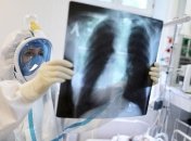 Пандемия COVID-19: Украина уже на 15-м месте в мире по количеству новых случаев 