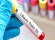 В лабораториях цена на этот вид диагностики вполне приемлема: от 70 грн