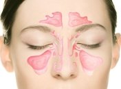 Народные средства и методы от гайморита