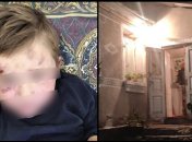 Перелом ноги и синяки по всему телу: мужчина зверски избил пасынка под Тернополем (фото)