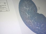 Американские ученые вырастили искусственную почку