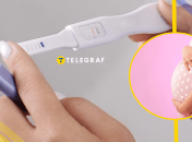 Бесплатное лечение бесплодия