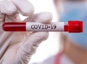 У Росії кількість хворих на COVID-19 перевищила 430 тисяч