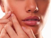 Методы лечения подкожных прыщей 