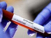 В Італії 20% медперсоналу інфікувалось коронавірусом