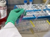 Минздрав планирует увеличить количество ПЦР-тестов на COVID-19 до 20 тыс в сутки