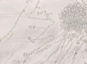 Без фунгицидов и ядовитых веществ: ученые разработали антигрибковое покрытие 