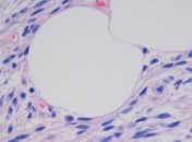 В США было создано уникальное лезвие для операций на клетках