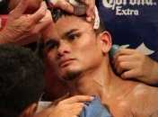 Майдана не выйдет на бой с Бронером в апреле