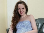 Болезнь превращает девушку в статую (Фото)