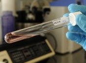 На Волині зафіксована перша підозра інфікування коронавірусом