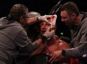 После боя с Джошуа Кличко наложили 9 швов на рассечение прямо в раздевалке