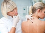 Тайна злокачественного перерождения родинок