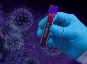 "Потрібно вчитися жити з цим": лікар відкрила, в якому стані залишаються видужалі від COVID-19