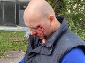 У центрі Києва жорстоко побили ветерана АТО: його дружина розкрила деталі події (відео)