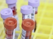 В Черкасской области подтвердили 141 случай заражения COVID-19