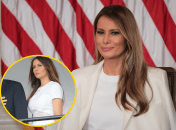 Делала ли Мелания Трамп пластические операции?