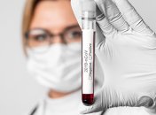 Киев, Одесса и Львов - в топе заболеваемости: свежая сводка COVID-19 на 7 июля