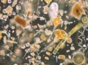 Бактерии в организме человека меняются генами быстрее, чем в природе