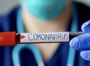 На Київщині вже підтвердили 140 випадків коронавірусу