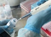 794 нових випадків коронавірусної хвороби виявлено за минулу добу