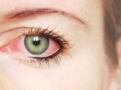 Как справиться с покраснением глаз