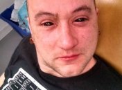 Биохакеры создали инъекцию, наделяющую человека ночным зрением