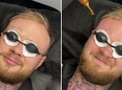 "Кернес больше не жив": харьковчанин расстался с нашумевшим тату (видео)