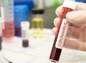 У Німеччині за добу зафіксовано більше 6 тисяч заражених коронавірусом