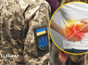 Ілюстрація