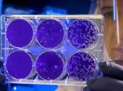 Генетики простежили маршрут коронавірусу по світу