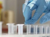 На Львовщине рекордное количество больных COVID-19: за сутки - 39 новых случаев