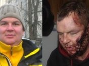 Булатову провели судебно-медицинские исследования в Литве