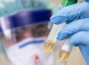 В Україні дослідили 20 зразків на коронавірус, жодну підозру не підтвердили