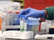 Пандемия коронавируса набирает обороты: на совещании у Зеленского утвердили план действий