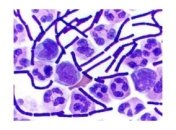 Кишечные бактерии формируют характер человека