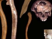 Ученые обнаружили аномалии развития у древних людей 