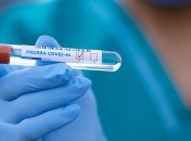 Где в Украине можно сдать бесплатный тест на COVID-19: появилась онлайн-карта