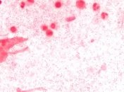 Появился еще до человека: найден белок, устойчивый к антибиотикам