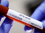 В Україні зафіксовано 4662 випадки COVID-19 