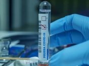 Больше тяжелых случаев и меньше выздоровевших: данные по коронавирусу в Украине 2 июня