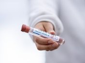 Коронавірус на Львівщині: зафіксовано майже дві сотні нових випадків