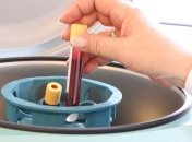 Потенциал технологий: ИИ сможет распознать инфаркт и инсульт по анализу крови