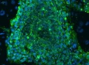 Ученые обнаружили древний вирус в геноме человека