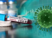 Статистика по коронавірусу в Україні продовжує поліпшуватися: дані на 17 травня