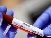 Як між областями розподілять меддопомогу з Китаю