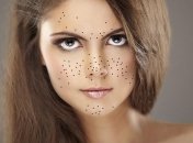 Что такое черные точки и как с ними бороться? 