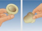 Цервикальный колпачок как метод контрацепции:что нужно знать