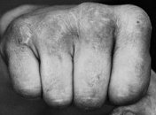 На Киевщине депутат избил тракториста